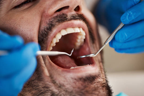 Best Emergency Cosmetic Dentistry (e.g., broken veneers) in Coldwater, MS